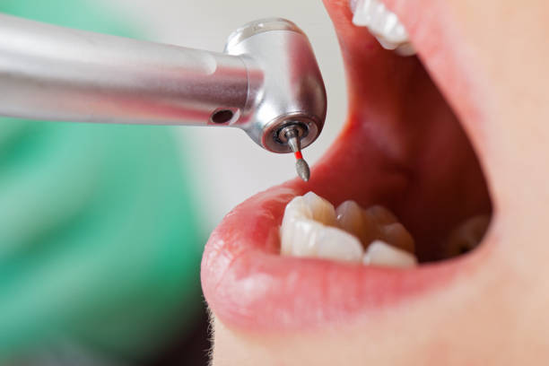 Best Emergency Treatment for Oral Infections in Hammond, IN